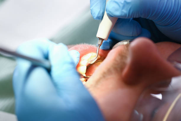 Best Emergency Denture Repair in Granite Quarry, NC