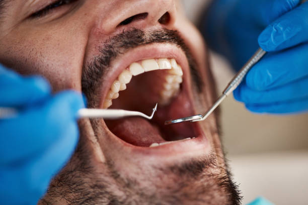 Best Emergency Treatment for Dental Infections or Abscesses in Granite Quarry, NC
